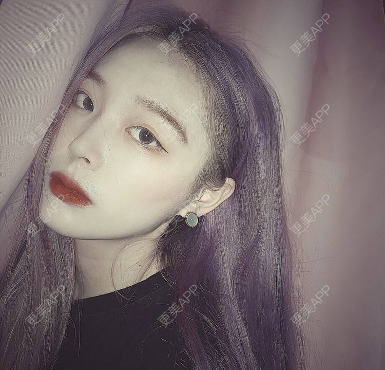 更美 - 冷语热心人的手术去副乳经验 | 手术去副乳 | 上海