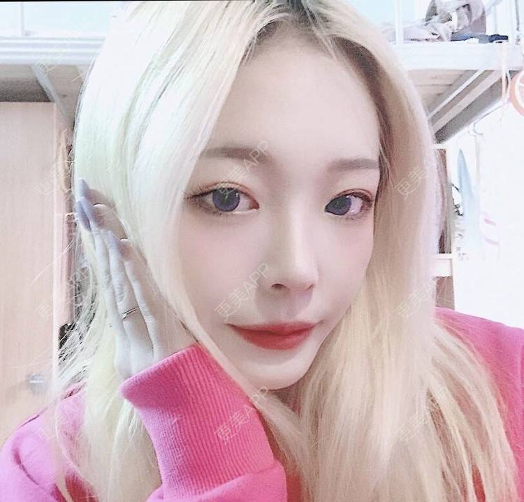 更美 - 冷语热心人的手术去副乳经验 | 手术去副乳 | 上海