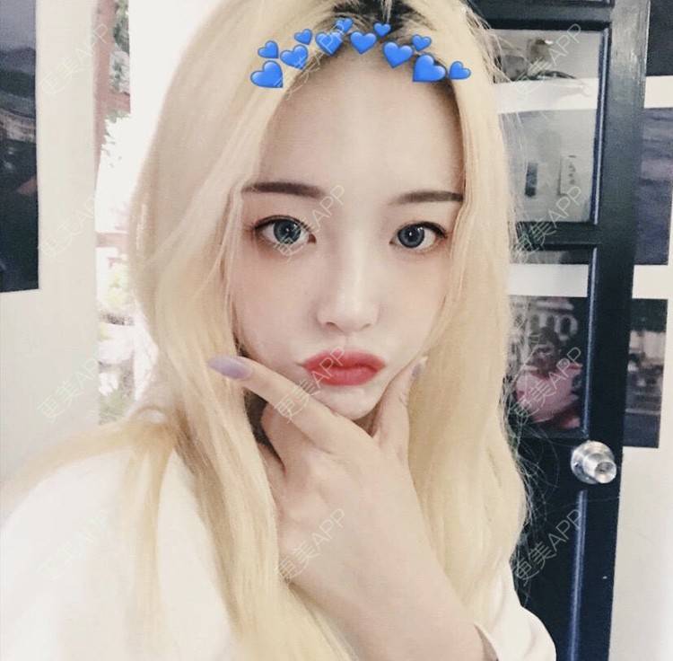 更美 - 冷语热心人的手术去副乳经验 | 手术去副乳 | 上海