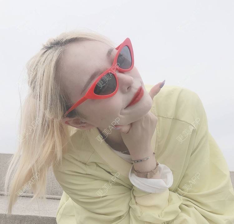 更美 - 冷语热心人的手术去副乳经验 | 手术去副乳 | 上海