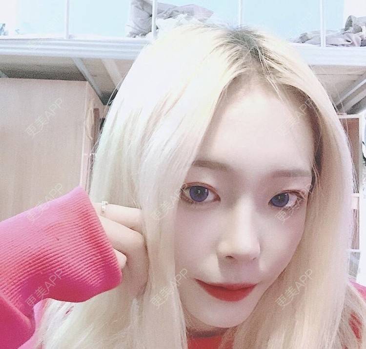 更美 - 冷语热心人的手术去副乳经验 | 手术去副乳 | 上海