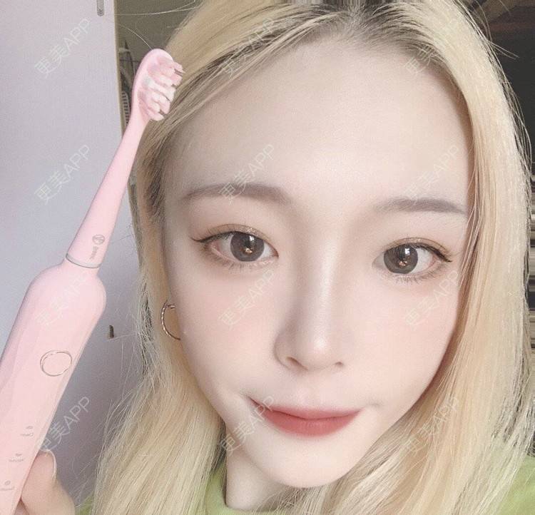 更美 - 冷语热心人的手术去副乳经验 | 手术去副乳 | 上海