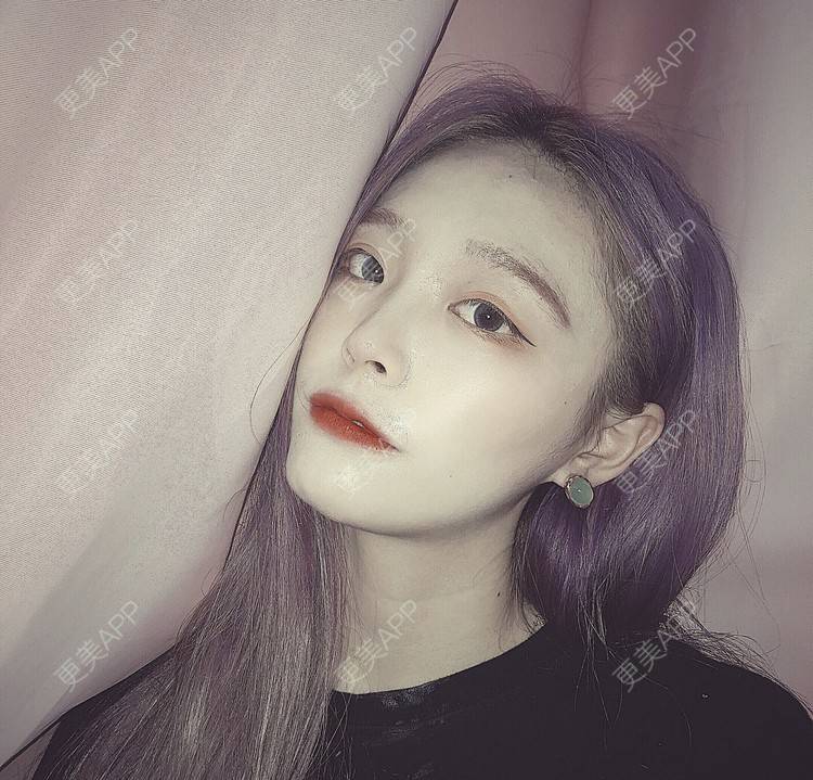 更美 - 冷语热心人的手术去副乳经验 | 手术去副乳 | 上海