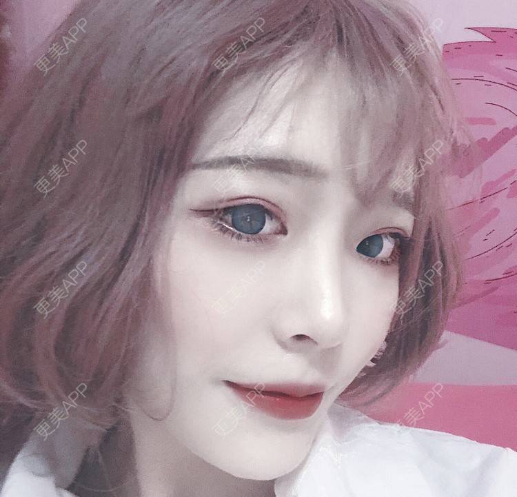 更美 - 冷语热心人的手术去副乳经验 | 手术去副乳 | 上海