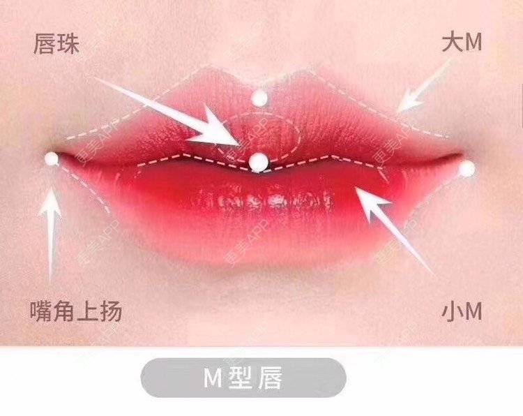 更美 - 祢的美丽/我的职责的M唇成形经验 | M唇成形 | 上海