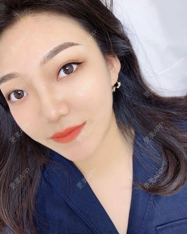 更美 - 更美用户DUrTv1xXun的半永久纹发际线经验 | 北京 | 半永久纹发际线