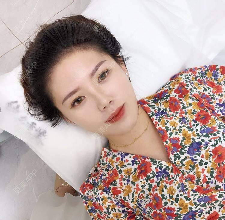 更美 - 更美用户DUrTv1xXun的半永久纹发际线经验 | 北京 | 半永久纹发际线
