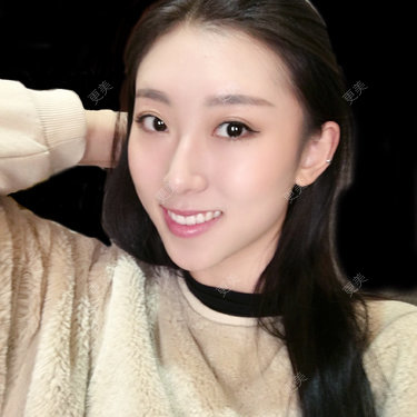 李桥莲 医生