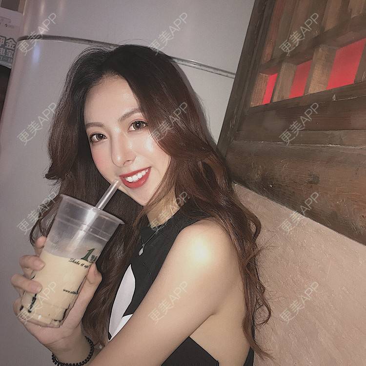 更美 - 更美用户u39F2J0uAP的玻尿酸下巴经验 | 玻尿酸下巴 | 南京