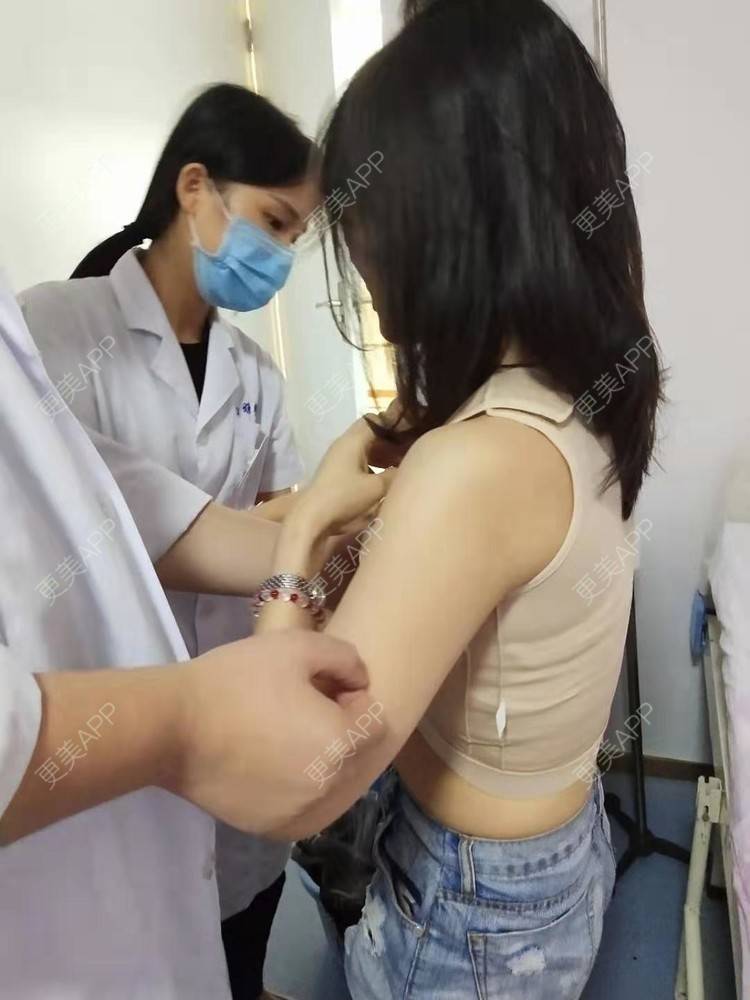 更美 - 农村小媳妇的胸部下垂矫正经验 | 胸部下垂矫正 | 深圳 | 乳晕缩小