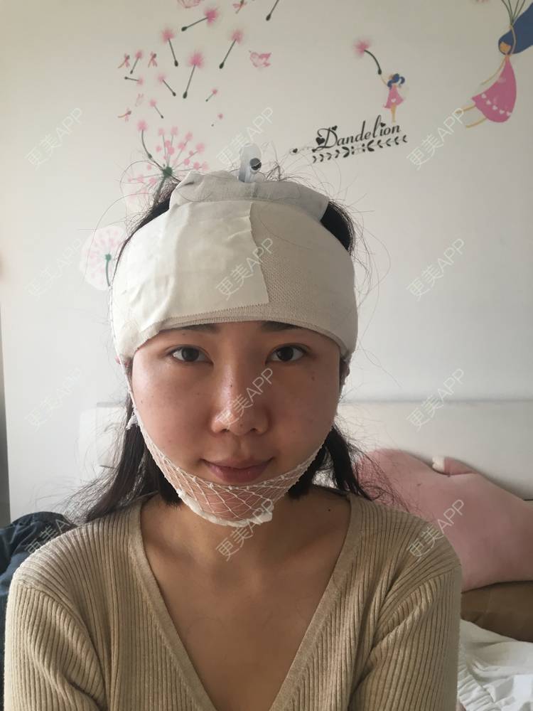更美 - 更美用户Oq3dIHx1xG的硅胶丰额头经验 | 额头 | 硅胶丰额头 | 武汉