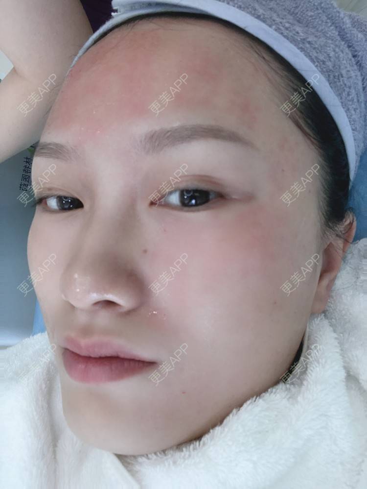 更美 - 高冷即气质的水光项目经验 | 水光项目 | 菲欧曼 | 皮肤综合管理套餐 | 深圳