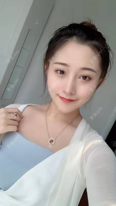 更美 - 更美用户RCbg4vVBWC的鼻部膨体假体取出经验 | 鼻部膨体假体取出 | 视频日记 | 长沙