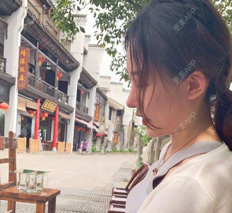 更美 - 更美用户RCbg4vVBWC的鼻部膨体假体取出经验 | 鼻部膨体假体取出 | 视频日记 | 长沙