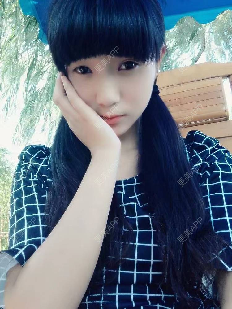 更美 - 更美用户5qvfduvcR7的双眼皮修复经验 | 双眼皮修复 | 眼袋修复