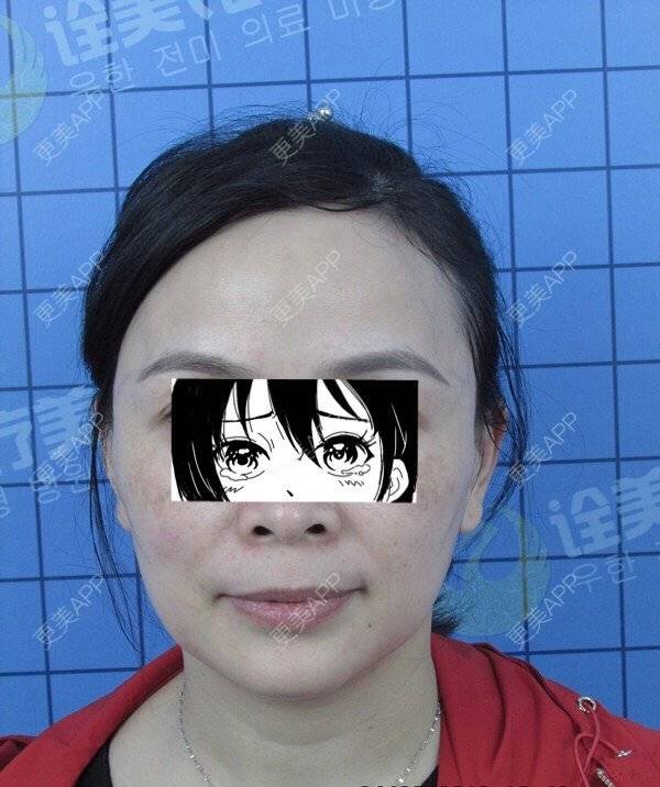 更美 - 丿Asmile、商的拉皮经验 | 拉皮 | 武汉