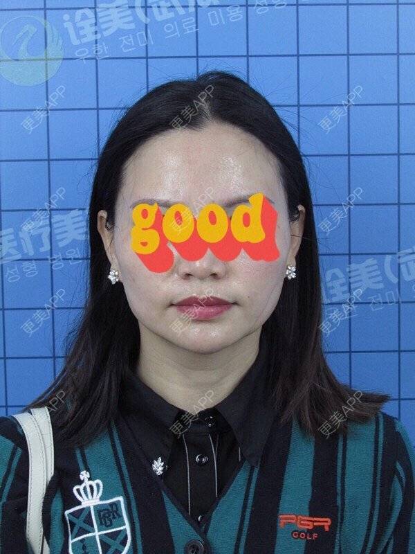更美 - 柔情全是误会的拉皮经验 | 武汉 | 拉皮