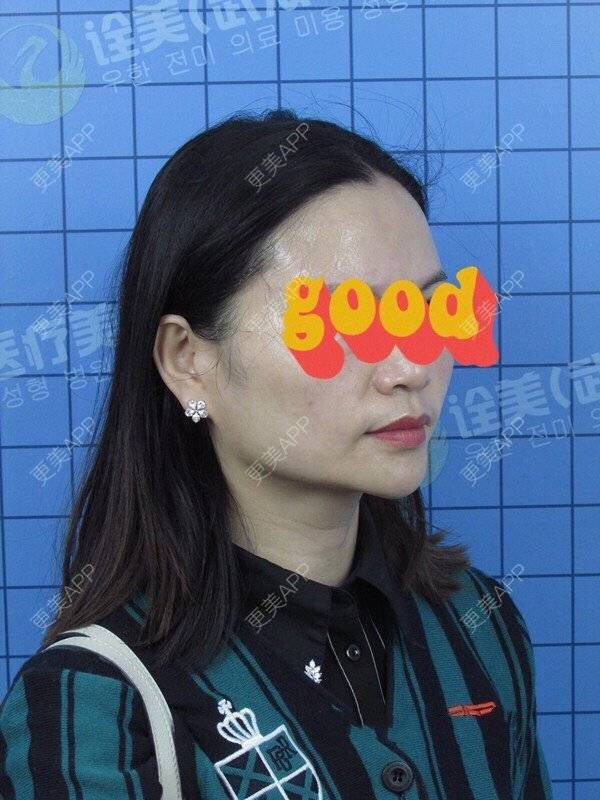 更美 - 柔情全是误会的拉皮经验 | 武汉 | 拉皮