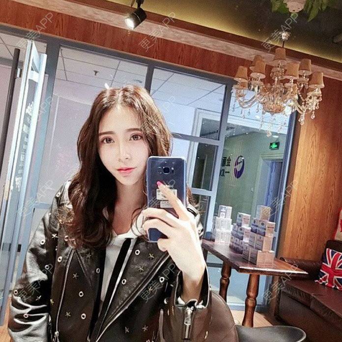 更美 - 更美用户rjPyXjXE2z的硅胶丰太阳穴经验 | 郑州 | 硅胶丰太阳穴 | 视频日记