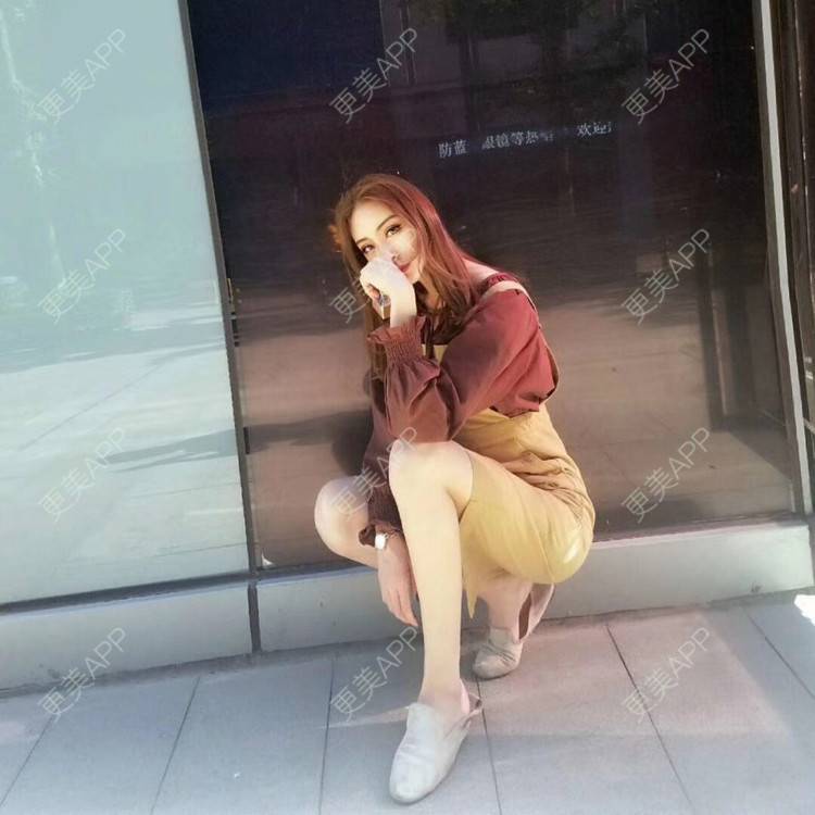 更美 - 更美用户rjPyXjXE2z的硅胶丰太阳穴经验 | 郑州 | 硅胶丰太阳穴 | 视频日记