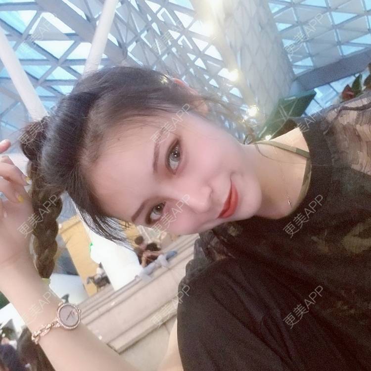 更美 - 更美用户rjPyXjXE2z的硅胶丰太阳穴经验 | 郑州 | 硅胶丰太阳穴 | 视频日记