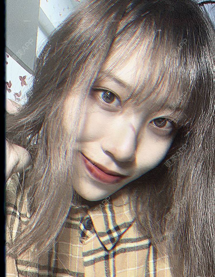 更美 - 本宫语的手术去副乳经验 | 手术去副乳 | 上海