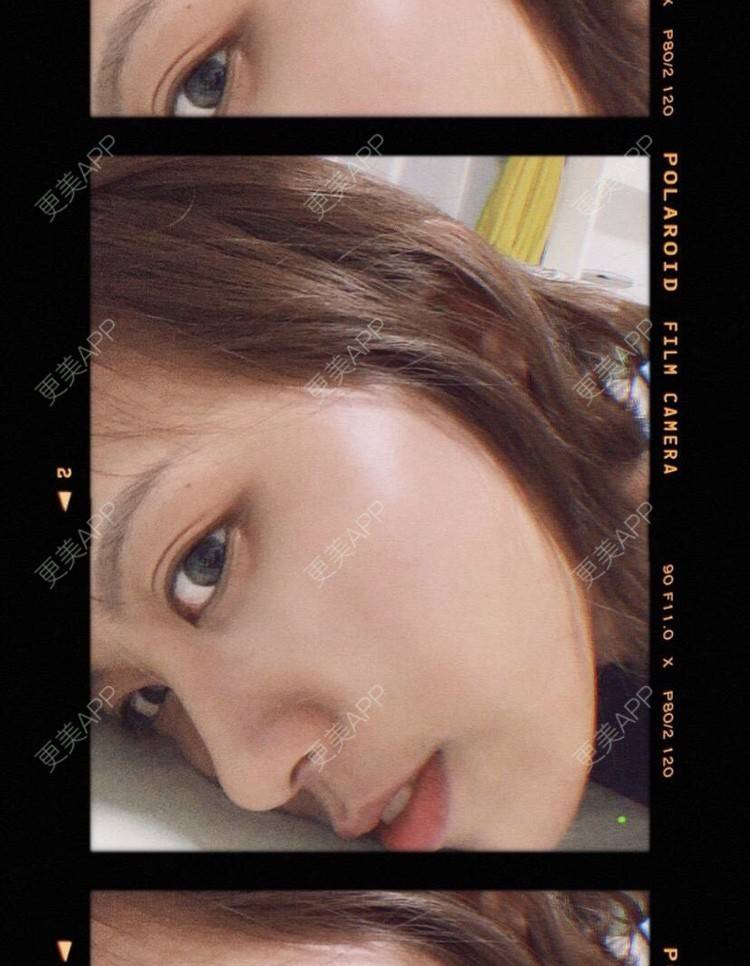 更美 - 本宫语的手术去副乳经验 | 手术去副乳 | 上海