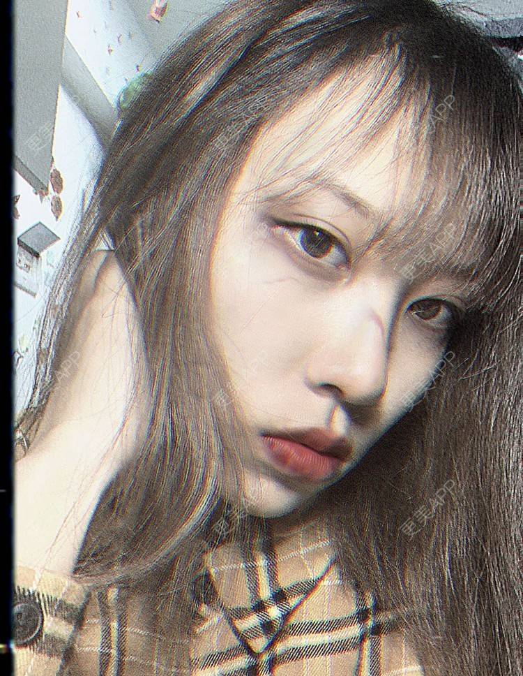 更美 - 本宫语的手术去副乳经验 | 手术去副乳 | 上海