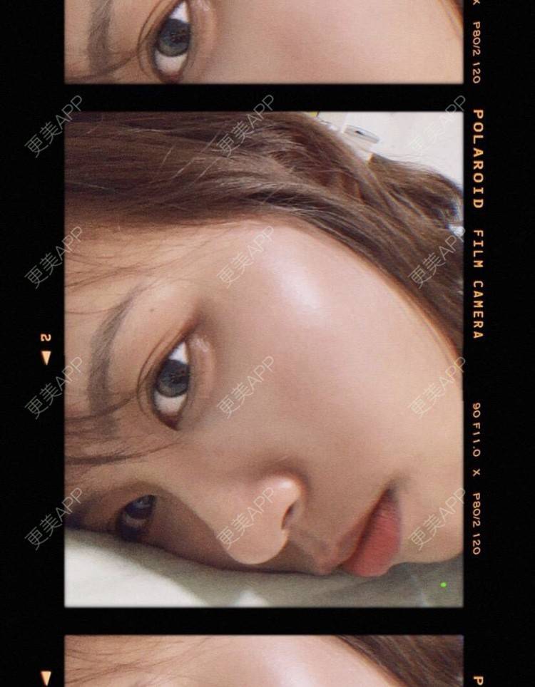 更美 - 本宫语的手术去副乳经验 | 手术去副乳 | 上海