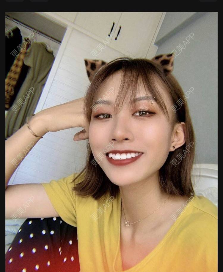 更美 - 本宫语的手术去副乳经验 | 手术去副乳 | 上海