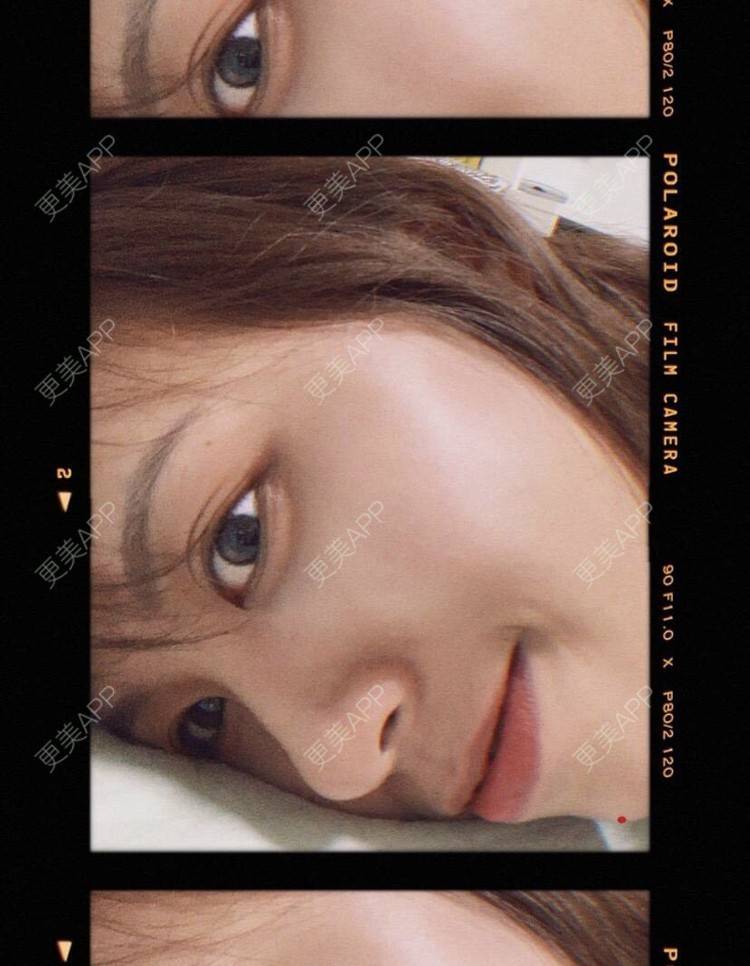 更美 - 本宫语的手术去副乳经验 | 手术去副乳 | 上海