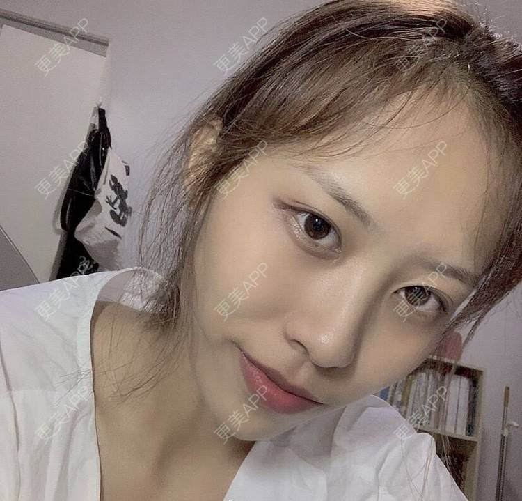 更美 - 本宫语的手术去副乳经验 | 手术去副乳 | 上海