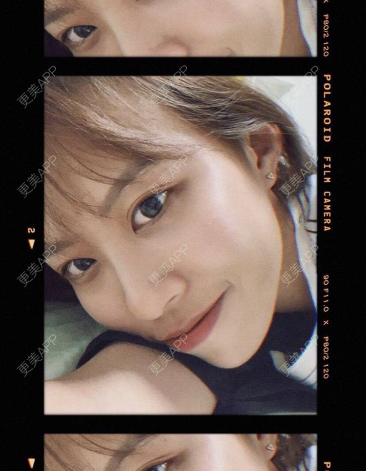 更美 - 本宫语的手术去副乳经验 | 手术去副乳 | 上海