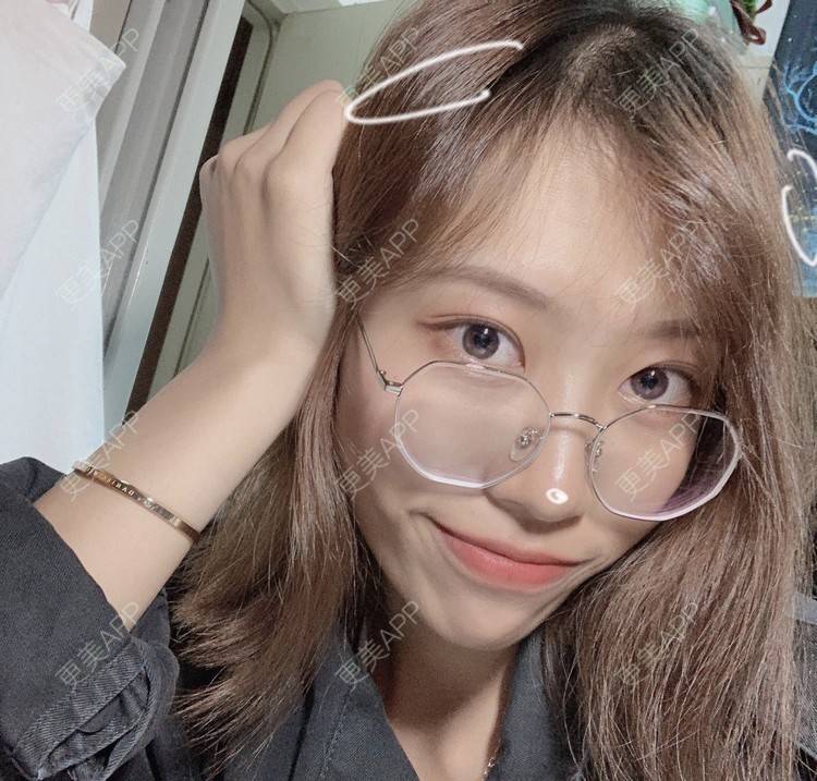 更美 - 本宫语的手术去副乳经验 | 手术去副乳 | 上海