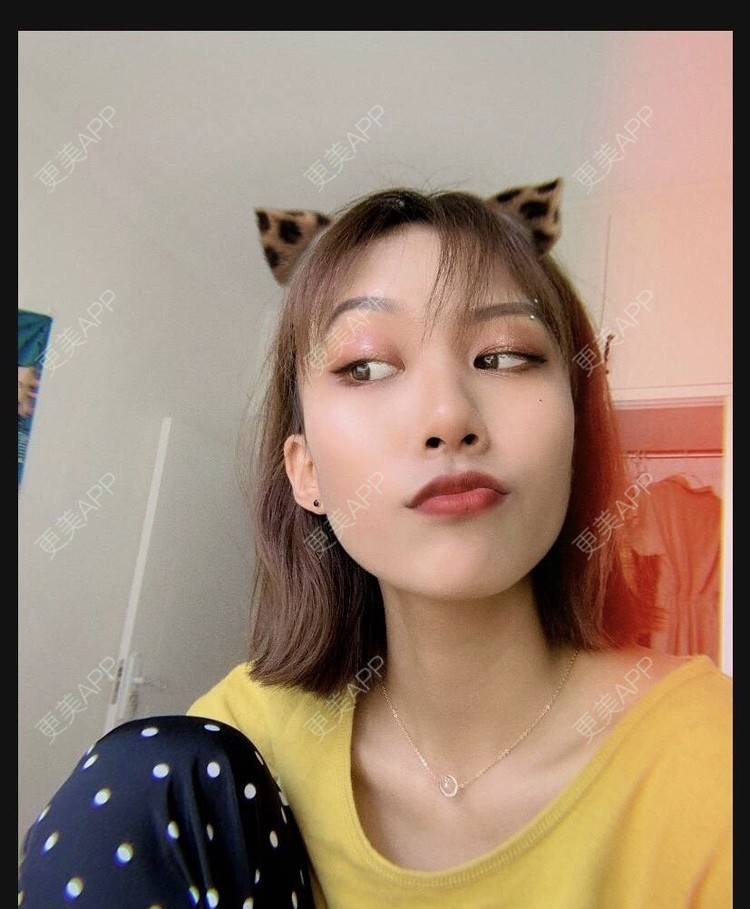 更美 - 本宫语的手术去副乳经验 | 手术去副乳 | 上海