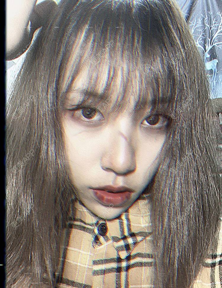 更美 - 本宫语的手术去副乳经验 | 手术去副乳 | 上海