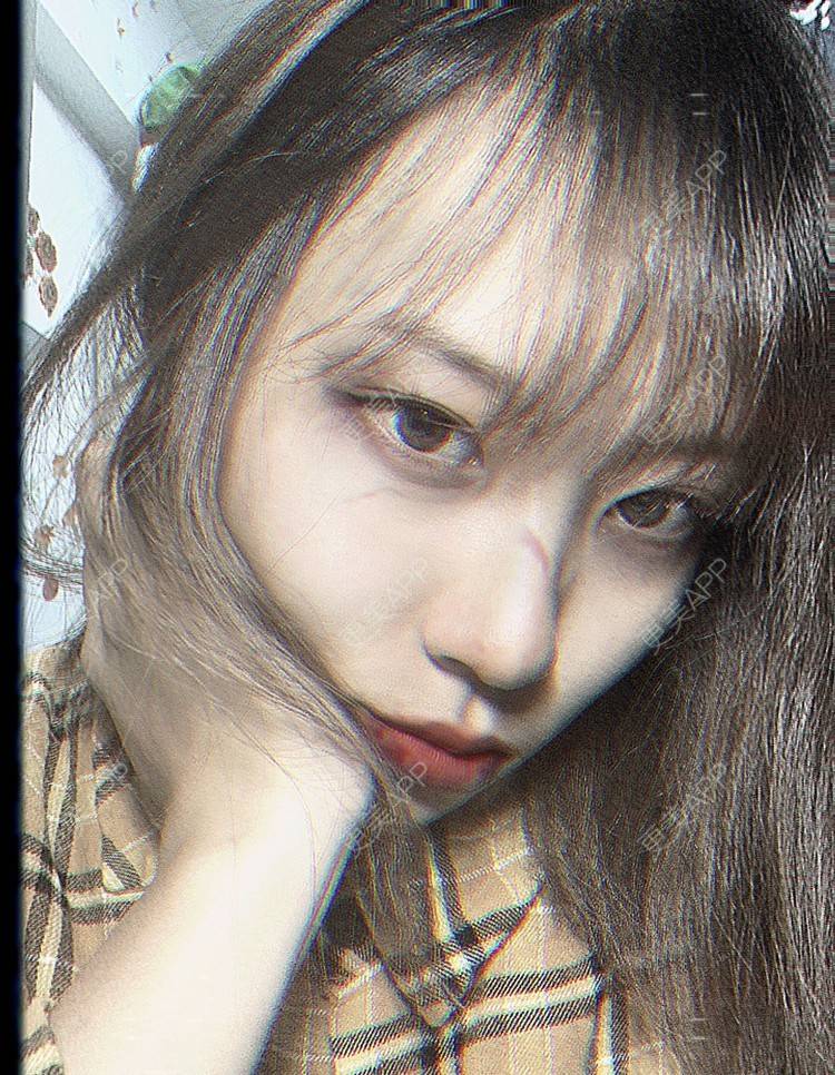 更美 - 本宫语的手术去副乳经验 | 手术去副乳 | 上海