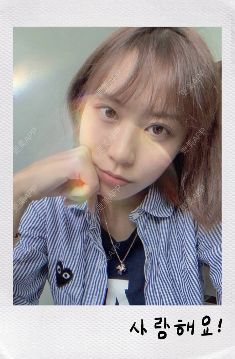 更美 - 本宫语的手术去副乳经验 | 手术去副乳 | 上海