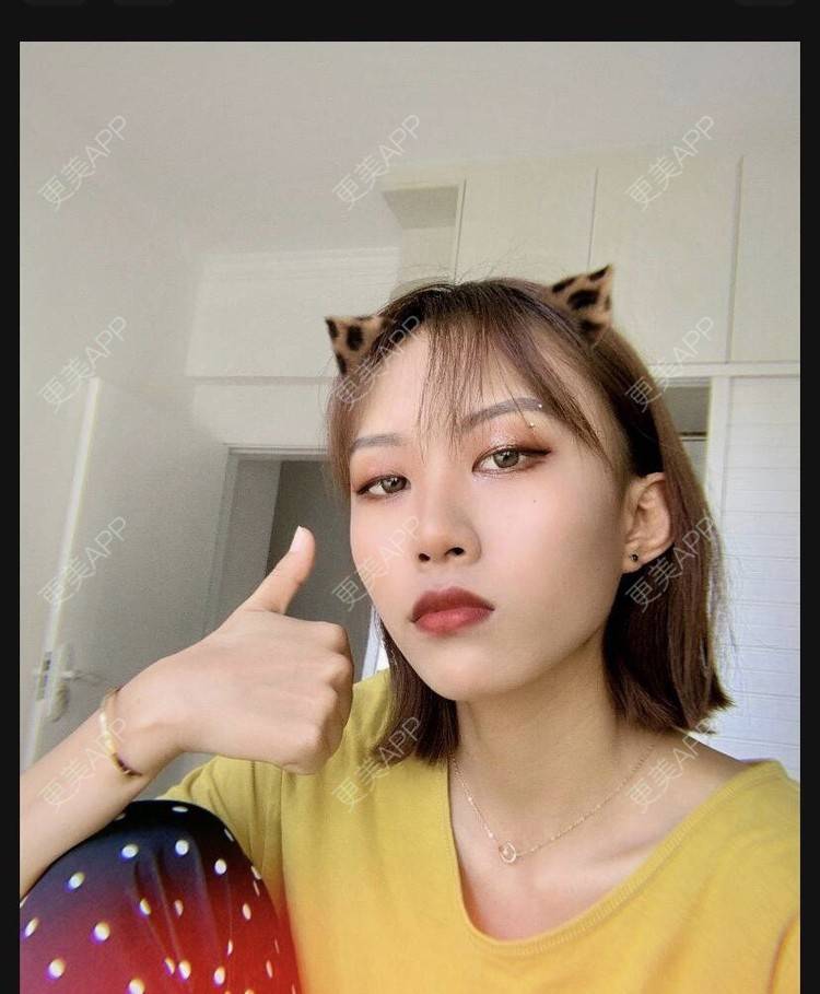 更美 - 本宫语的手术去副乳经验 | 手术去副乳 | 上海