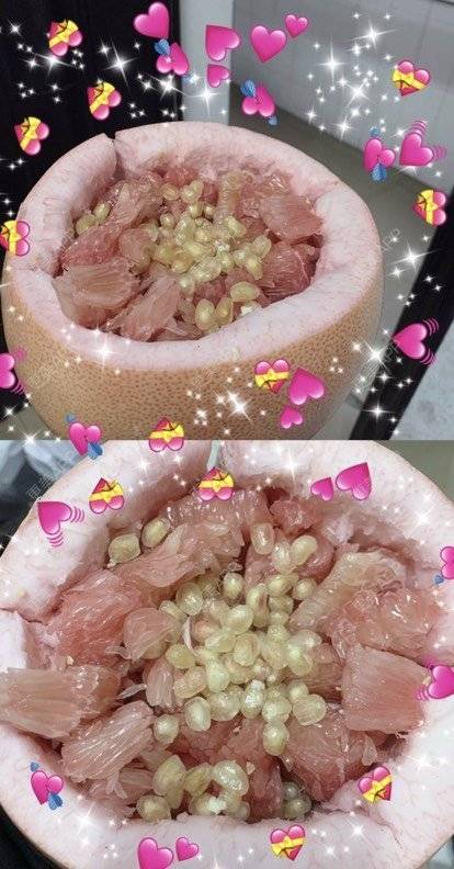 更美 - 寂静的时间的乳头内陷矫正经验 | 乳头内陷矫正 | 上海