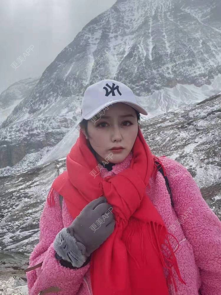 更美 - 更美用户dapPewZ45A的自体脂肪丰额头经验 | 自体脂肪丰额头 | 重庆