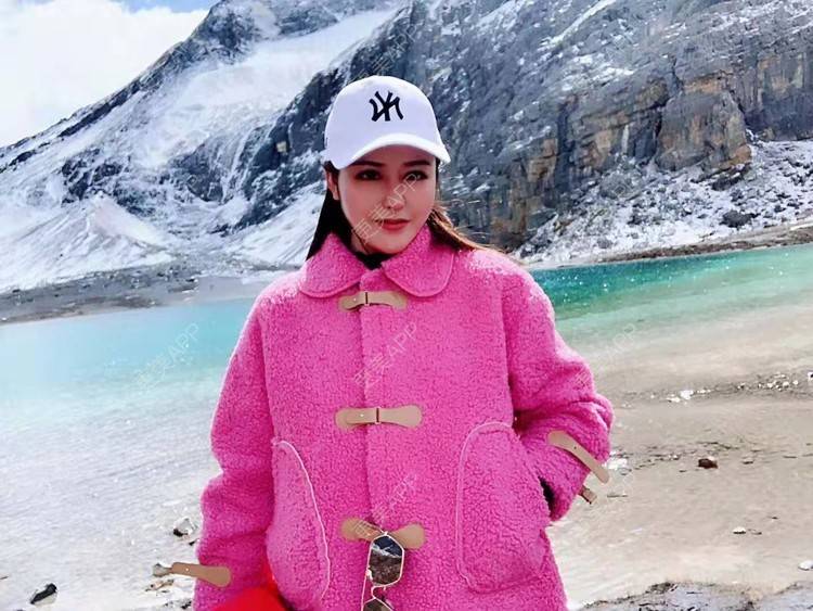 更美 - 更美用户dapPewZ45A的自体脂肪丰额头经验 | 自体脂肪丰额头 | 重庆