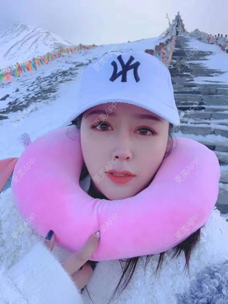 更美 - 更美用户dapPewZ45A的自体脂肪丰额头经验 | 自体脂肪丰额头 | 重庆