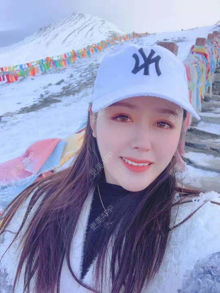 更美 - 更美用户dapPewZ45A的自体脂肪丰额头经验 | 自体脂肪丰额头 | 重庆