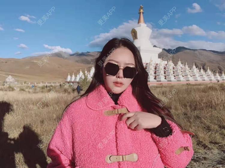 更美 - 更美用户dapPewZ45A的自体脂肪丰额头经验 | 自体脂肪丰额头 | 重庆