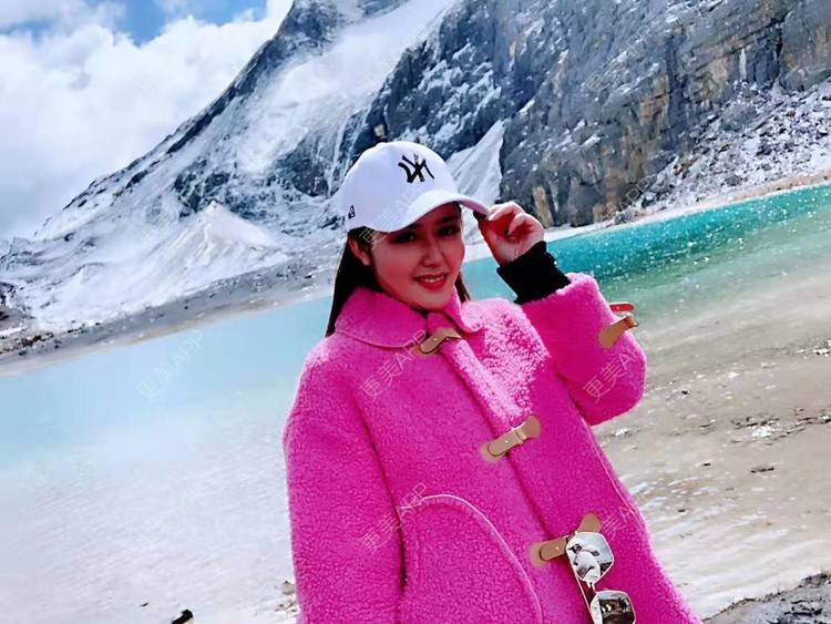 更美 - 更美用户dapPewZ45A的自体脂肪丰额头经验 | 自体脂肪丰额头 | 重庆