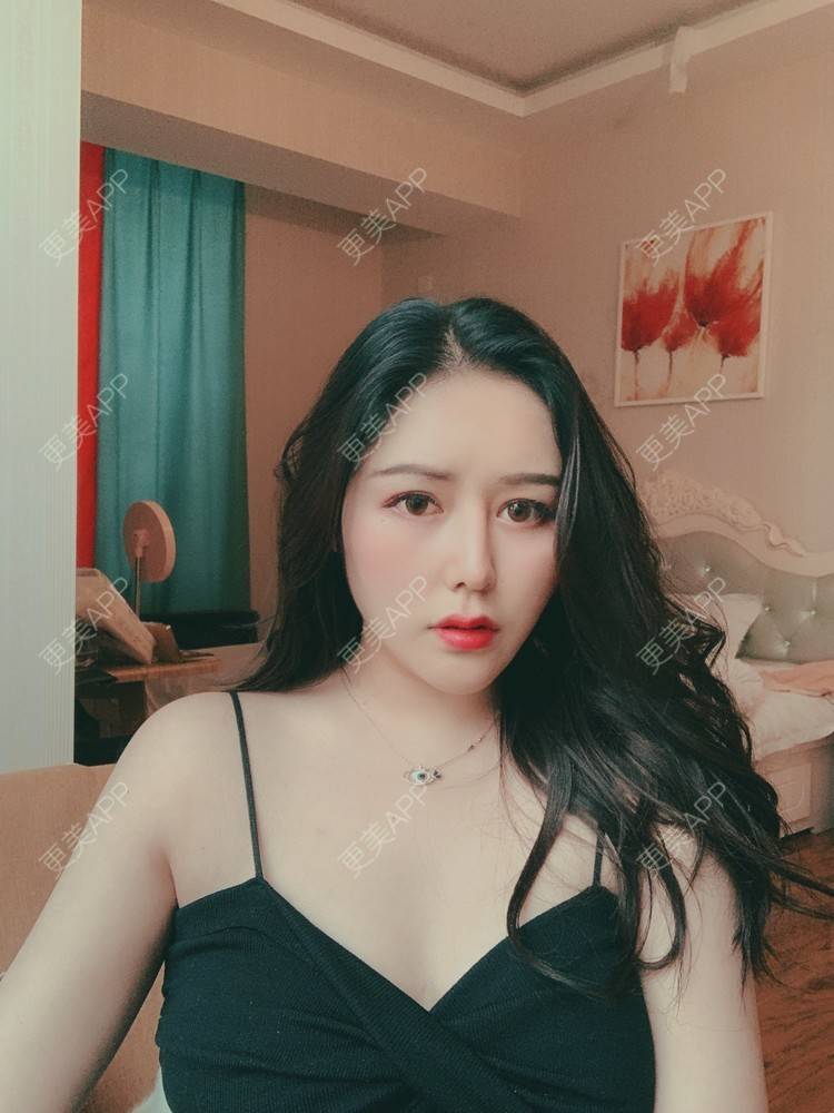 更美 - 更美用户dapPewZ45A的自体脂肪丰额头经验 | 自体脂肪丰额头 | 重庆