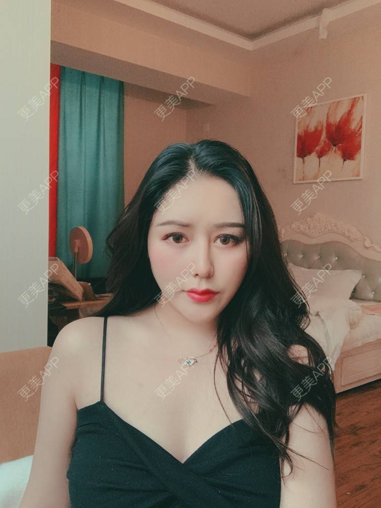 更美 - 更美用户dapPewZ45A的自体脂肪丰额头经验 | 自体脂肪丰额头 | 重庆
