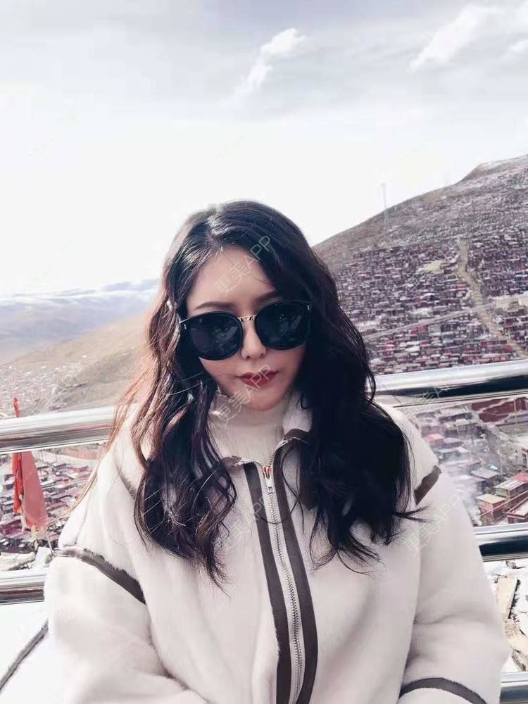 更美 - 更美用户dapPewZ45A的自体脂肪丰额头经验 | 自体脂肪丰额头 | 重庆