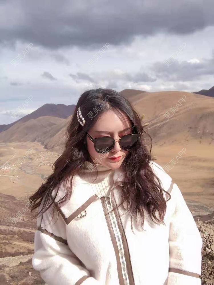 更美 - 更美用户dapPewZ45A的自体脂肪丰额头经验 | 自体脂肪丰额头 | 重庆